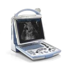 全數(shù)字便攜式超聲診斷系統(tǒng) dp-10