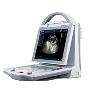 全數(shù)字b型超聲診斷儀kx5600 代理