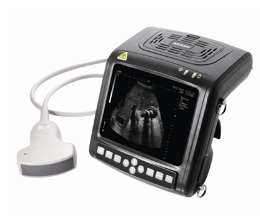 全數(shù)字超小型b超機kx5600