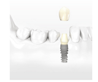 義齒基托樹脂139