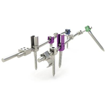 脊柱復(fù)位內(nèi)固定系統(tǒng)