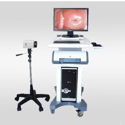 光學(xué)電子陰道鏡wh-sma