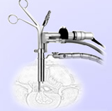 經(jīng)皮穿刺椎間盤手術系統(tǒng)dcd-jⅠ