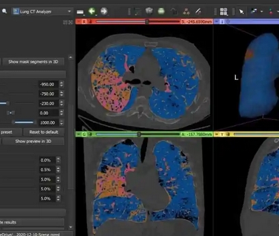 乳腺mri醫(yī)學(xué)影像存儲傳輸與處理軟件