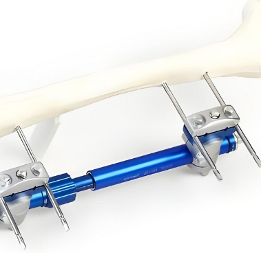 泰瑞博思醫(yī)用外固定支具