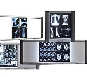 九爾x射線膠片觀片燈