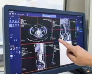 醫(yī)學(xué)影像信息系統(tǒng)yxpacs