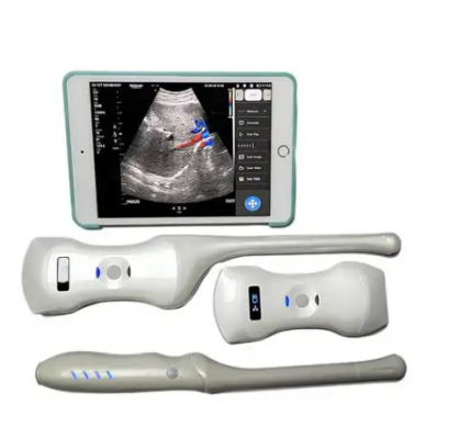 無線掌上彩色多普勒超聲顯像儀m6