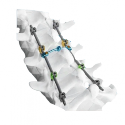 胸腰椎后路內固定系統海星