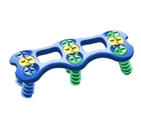 頸椎前路內(nèi)固定系統(tǒng)郎和