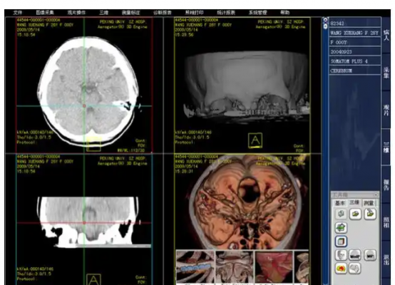 醫(yī)學影像信息管理與網(wǎng)絡通訊系統(tǒng)medipacs