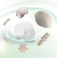 顱骨固定系統(tǒng)吉美瑞