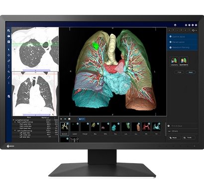 圖像處理器醫(yī)光vpu-200