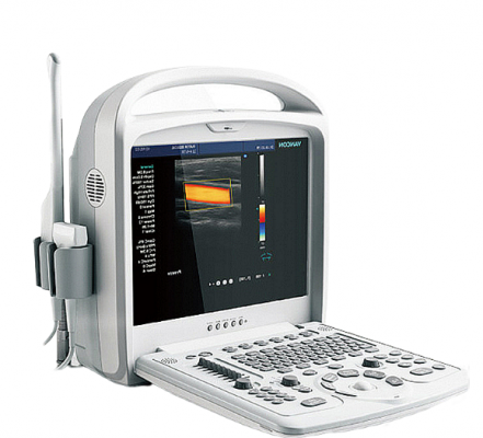 全數(shù)字掌上式彩色多普勒超聲顯像儀readius l5