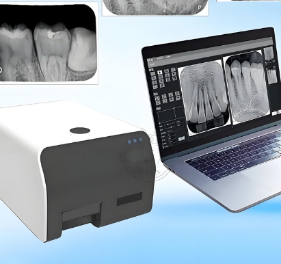 dfc-4t-wide牙科影像板掃描儀登特菲代理商
