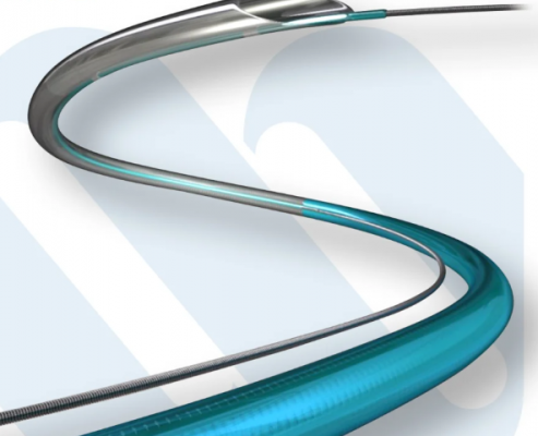 下肢動脈取血栓導管vm-src-403f廠家