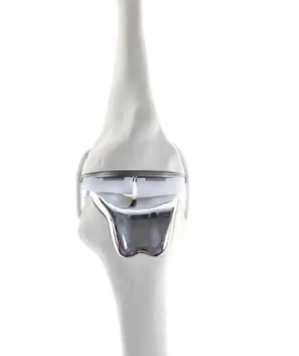膝關(guān)節(jié)假體春立正達(dá)代理