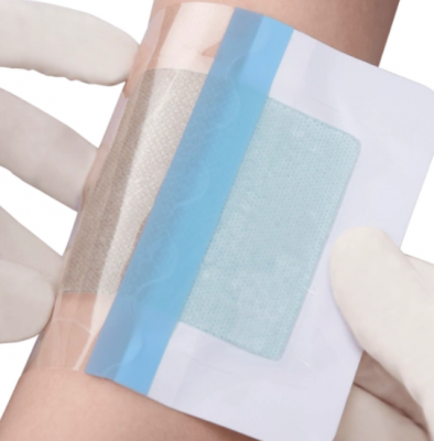 醫(yī)用液體傷口敷料10ml批發(fā)價