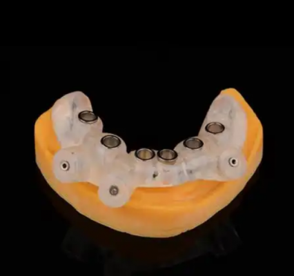 定制式牙科種植用導板y-k1供應商