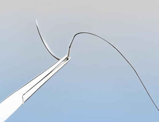 一次性鈦鎳合金特殊縫線福泰采購價