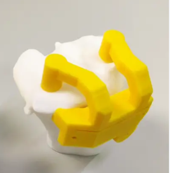 膝關(guān)節(jié)截骨個性化手術(shù)導(dǎo)板htopm-a廠家