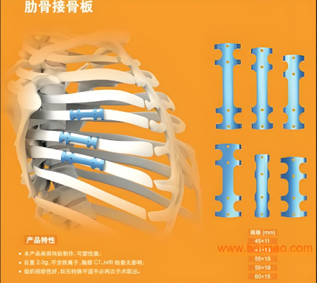 郎和醫(yī)療肋骨接骨板廠家