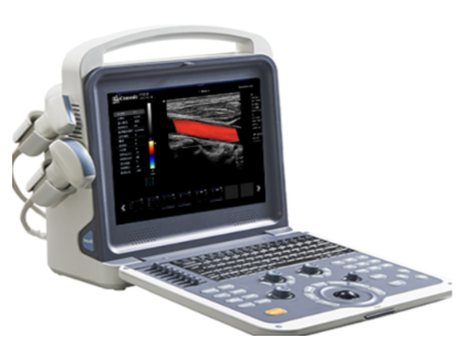 攜帶式彩色多普勒超聲診斷儀kcu-m8exp廠家