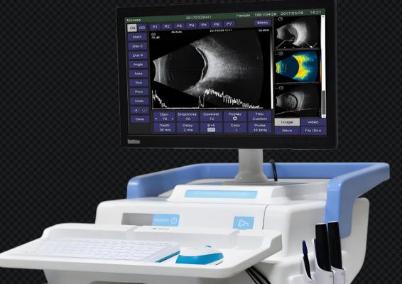 眼科a/b型超聲診斷儀 sdk/180/a.b.s 廠家