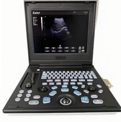 掌上彩色多普勒超聲系統(tǒng)h70  廠家