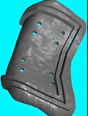 ty-jgdb-sz 個性化增材制造截骨導(dǎo)板廠家