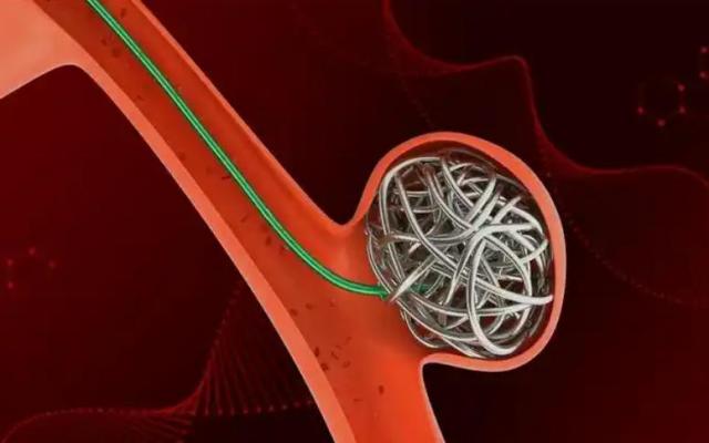 jh-mc21150str 神經(jīng)血管微導(dǎo)管 廠家