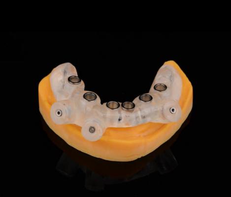 定制式牙科種植導(dǎo)板 廠家