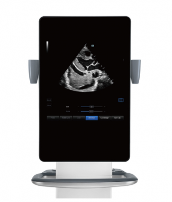 te9麻醉彩超機供應商