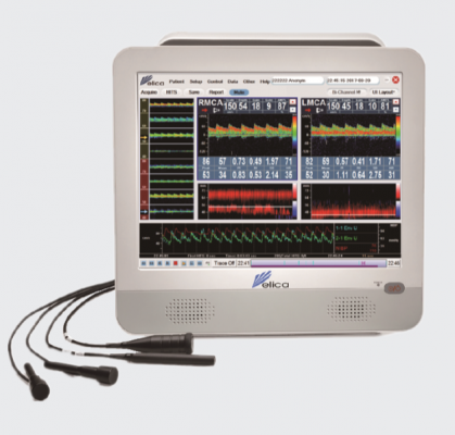 ems—9k超聲經(jīng)顱多普勒血流分析儀代理
