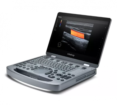 mx3t便攜式彩色多普勒超聲診斷儀供應(yīng)商