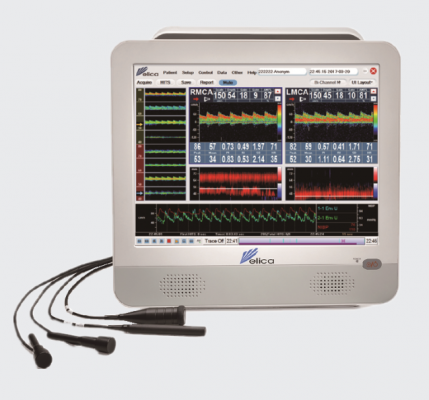 3d1超聲經(jīng)顱多普勒血流分析儀詢價(jià)