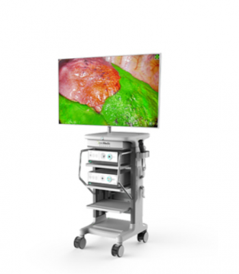 si10 胸腹腔內(nèi)窺鏡供應(yīng)商