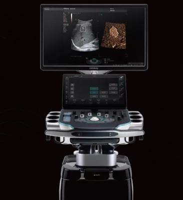 resona a20s全身及介入彩色多普勒超聲診斷儀廠(chǎng)家