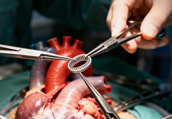 三尖瓣成形帶 美敦力廠家