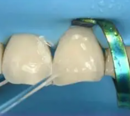 牙科粘接劑廣東代理