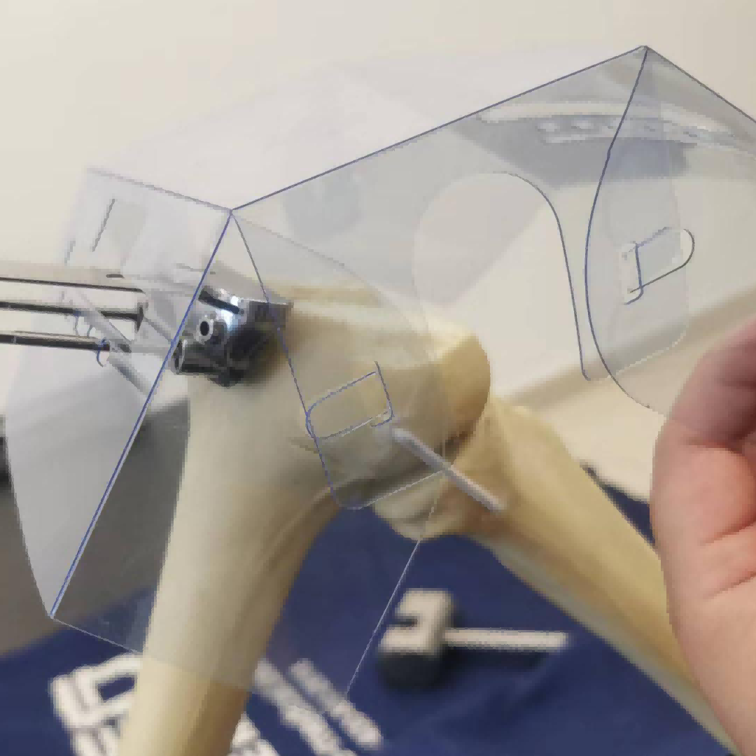 大博膝關(guān)節(jié)截骨保護(hù)器pet Ⅰ規(guī)格 0.5mm / 0.8mm）