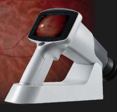 美沃手持式眼底照相機(jī)fc161